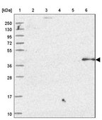 Anti-OSGEP antibody produced in rabbit Prestige Antibodies® Powered by Atlas Antibodies, affinity isolated antibody, buffered aqueous glycerol solution