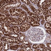 Anti-ACAD8 antibody produced in rabbit Prestige Antibodies® Powered by Atlas Antibodies, affinity isolated antibody, buffered aqueous glycerol solution