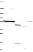 Anti-IL10RA antibody produced in rabbit Prestige Antibodies® Powered by Atlas Antibodies, affinity isolated antibody, buffered aqueous glycerol solution