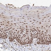 Anti-GTF3C6 antibody produced in rabbit Prestige Antibodies® Powered by Atlas Antibodies, affinity isolated antibody, buffered aqueous glycerol solution