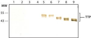 Anti-TTP (N-terminal) antibody produced in rabbit ~1.0 mg/mL, affinity isolated antibody, buffered aqueous solution