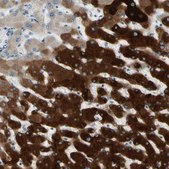 Anti-CYP2E1 antibody produced in rabbit Prestige Antibodies® Powered by Atlas Antibodies, affinity isolated antibody, buffered aqueous glycerol solution