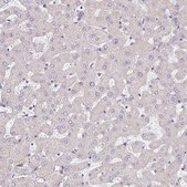 Anti-TMEM119 antibody produced in rabbit Prestige Antibodies® Powered by Atlas Antibodies, affinity isolated antibody, buffered aqueous glycerol solution