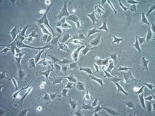 SK-MEL-37 Human Melanoma Cell Line