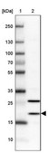 Anti-BTF3L4 antibody produced in rabbit Prestige Antibodies® Powered by Atlas Antibodies, affinity isolated antibody, buffered aqueous glycerol solution