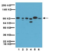 Anti-MMP-9 Antibody, Catalytic domain Chemicon®, from rabbit