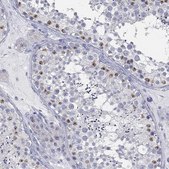 Anti-USP29 antibody produced in rabbit Prestige Antibodies® Powered by Atlas Antibodies, affinity isolated antibody, buffered aqueous glycerol solution