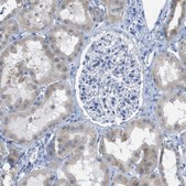 Anti-TEX264 antibody produced in rabbit Prestige Antibodies® Powered by Atlas Antibodies, affinity isolated antibody, buffered aqueous glycerol solution