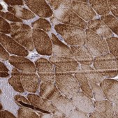Monoclonal Anti-MYH6 antibody produced in mouse Prestige Antibodies® Powered by Atlas Antibodies, clone CL2148, purified immunoglobulin, buffered aqueous glycerol solution