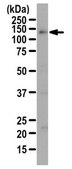 Anti-TIF1-alpha Antibody from rabbit, purified by affinity chromatography