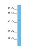 Anti-RNF135 antibody produced in rabbit affinity isolated antibody