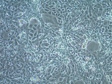 ID8 Mouse Ovarian Surface Epithelial Cell Line ID8 mouse ovarian surface epithelial cell line is frequently used as a syngeneic mouse model for human ovarian cancer.