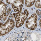 Anti-CYB5R1 antibody produced in rabbit Prestige Antibodies® Powered by Atlas Antibodies, affinity isolated antibody, buffered aqueous glycerol solution