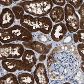 Anti-ACO1 antibody produced in rabbit Prestige Antibodies® Powered by Atlas Antibodies, affinity isolated antibody, buffered aqueous glycerol solution, Ab1