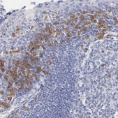 Anti-LAX1 antibody produced in rabbit Ab1, Prestige Antibodies® Powered by Atlas Antibodies, affinity isolated antibody, buffered aqueous glycerol solution