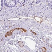 Anti-IGF1 antibody produced in rabbit Prestige Antibodies® Powered by Atlas Antibodies, affinity isolated antibody, buffered aqueous glycerol solution