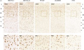 Anti-ALKBH5 antibody produced in rabbit Prestige Antibodies® Powered by Atlas Antibodies, affinity isolated antibody, buffered aqueous glycerol solution