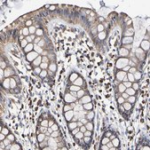 Anti-IL18R1 antibody produced in rabbit Prestige Antibodies® Powered by Atlas Antibodies, affinity isolated antibody, buffered aqueous glycerol solution