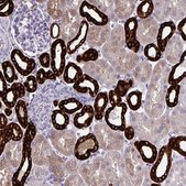 Anti-HSD11B2 antibody produced in rabbit Prestige Antibodies® Powered by Atlas Antibodies, affinity isolated antibody, buffered aqueous glycerol solution