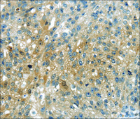 Anti-UPP2 affinity isolated antibody