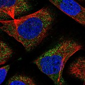 Anti-CNOT6 antibody produced in rabbit Prestige Antibodies® Powered by Atlas Antibodies, affinity isolated antibody, buffered aqueous glycerol solution