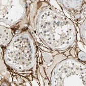 Anti-NGFR antibody produced in rabbit Prestige Antibodies® Powered by Atlas Antibodies, affinity isolated antibody, buffered aqueous glycerol solution