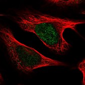 Anti-UXT antibody produced in rabbit Prestige Antibodies® Powered by Atlas Antibodies, affinity isolated antibody, buffered aqueous glycerol solution