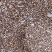 Anti-PSD4 antibody produced in rabbit Prestige Antibodies® Powered by Atlas Antibodies, affinity isolated antibody, buffered aqueous glycerol solution