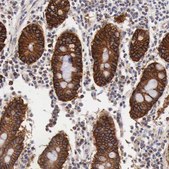 Anti-XPNPEP3 antibody produced in rabbit Prestige Antibodies® Powered by Atlas Antibodies, affinity isolated antibody, buffered aqueous glycerol solution