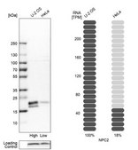 Anti-NPC2 antibody produced in rabbit Prestige Antibodies® Powered by Atlas Antibodies, affinity isolated antibody, buffered aqueous glycerol solution