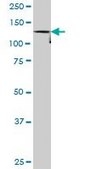 Monoclonal Anti-DDEF1, (C-terminal) antibody produced in mouse clone 1B5, purified immunoglobulin, buffered aqueous solution