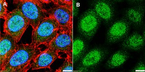 Anti-STXBP1/MUNC18-1 Antibody, clone 2K7 ZooMAb® Rabbit Monoclonal recombinant, expressed in HEK 293 cells
