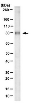 Anti-Plakophilin 1 Antibody, clone 10B2 clone 10B2, from mouse | Sigma ...