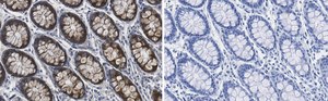 Anti-MMP-14 Antibody, clone 1J5 ZooMAb® Rabbit Monoclonal recombinant, expressed in HEK 293 cells