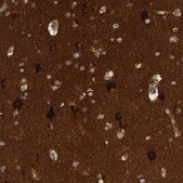 Anti-BAIAP2 antibody produced in rabbit affinity isolated antibody, buffered aqueous glycerol solution