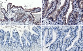 Anti-AMPK α1 Antibody Upstate®, from rabbit