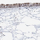 Anti-CEP164 antibody produced in rabbit Prestige Antibodies® Powered by Atlas Antibodies, affinity isolated antibody, buffered aqueous glycerol solution