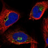 Anti-OSBP antibody produced in rabbit Prestige Antibodies® Powered by Atlas Antibodies, affinity isolated antibody, buffered aqueous glycerol solution
