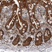 Anti-PSMB2 antibody produced in rabbit Prestige Antibodies® Powered by Atlas Antibodies, affinity isolated antibody, buffered aqueous glycerol solution, Ab1