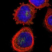 Anti-ZDHHC13 antibody produced in rabbit Prestige Antibodies® Powered by Atlas Antibodies, affinity isolated antibody, buffered aqueous glycerol solution