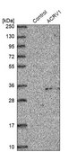 Anti-ACRV1 antibody produced in rabbit Prestige Antibodies® Powered by Atlas Antibodies, affinity isolated antibody, buffered aqueous glycerol solution