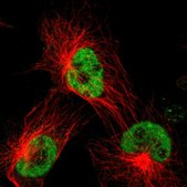 Anti-TAF1 antibody produced in rabbit Prestige Antibodies® Powered by Atlas Antibodies, affinity isolated antibody, buffered aqueous glycerol solution