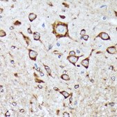 Anti-BNIP1 antibody produced in rabbit