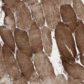 Anti-AKAP1 antibody produced in rabbit Prestige Antibodies® Powered by Atlas Antibodies, affinity isolated antibody, buffered aqueous glycerol solution