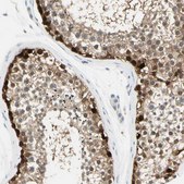 Anti-ASB9 antibody produced in rabbit Ab2, Prestige Antibodies® Powered by Atlas Antibodies, affinity isolated antibody, buffered aqueous glycerol solution
