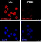 Dipg Color Human DIPG Cell Line Glioma Therapeutic Screening Millipore