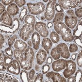 Anti-COA7 antibody produced in rabbit Prestige Antibodies® Powered by Atlas Antibodies, affinity isolated antibody, buffered aqueous glycerol solution, ab2