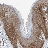 Anti-EIF4EBP1 antibody produced in rabbit Prestige Antibodies® Powered by Atlas Antibodies, affinity isolated antibody, buffered aqueous glycerol solution