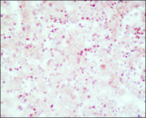 Monoclonal Anti-α-Fetoprotein (AFP) antibody produced in mouse ascites fluid, clone C3