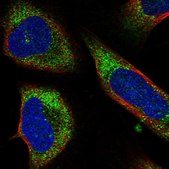 Anti-CCZ1 antibody produced in rabbit Prestige Antibodies® Powered by Atlas Antibodies, affinity isolated antibody, buffered aqueous glycerol solution